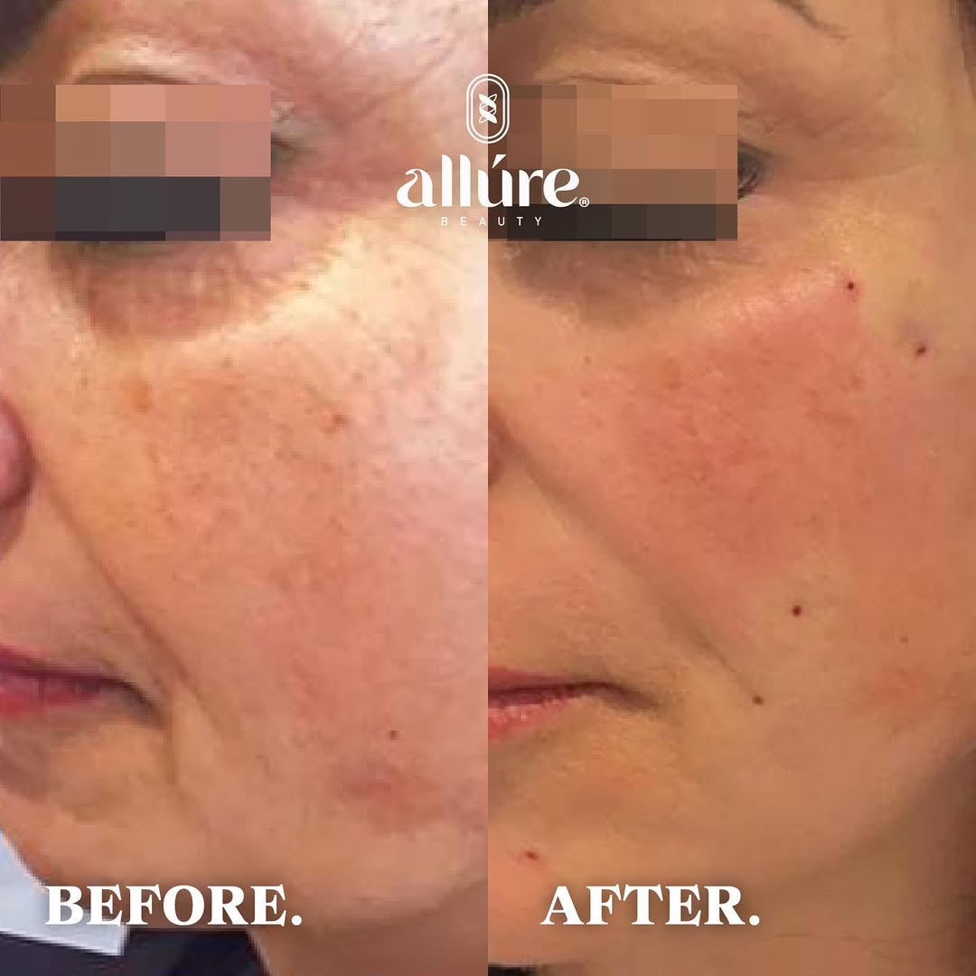 Jamber before and after result, case 28