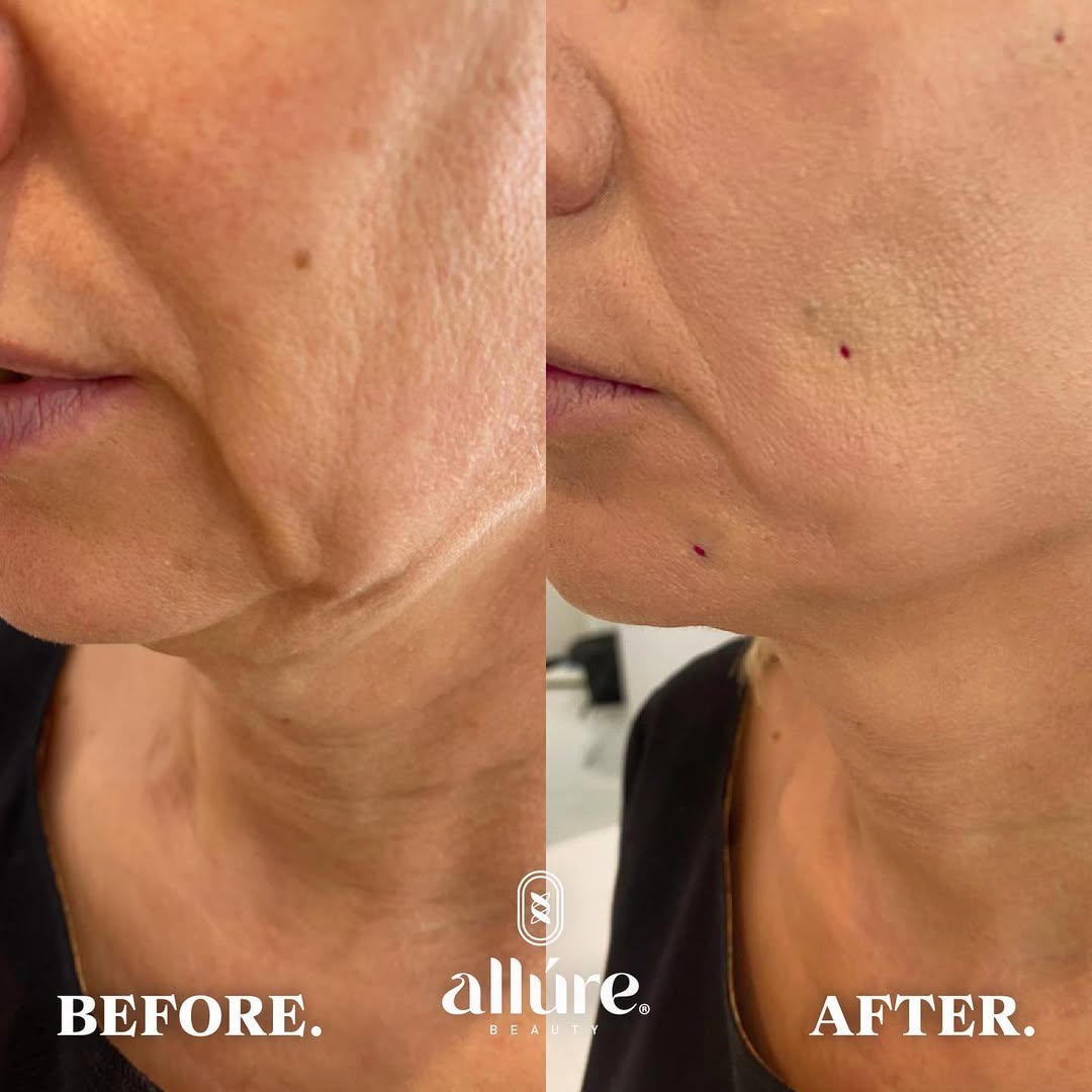 Jamber before and after result, case 27