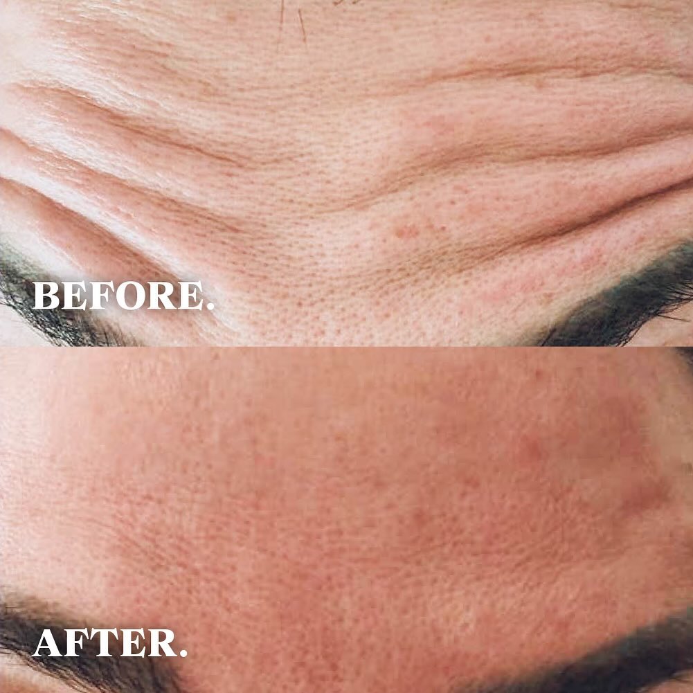 Jamber before and after result, case 21