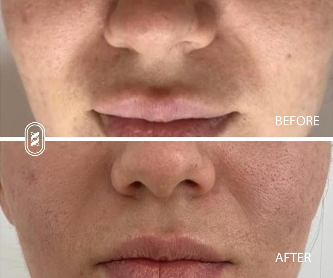 Jamber before and after result, case 13