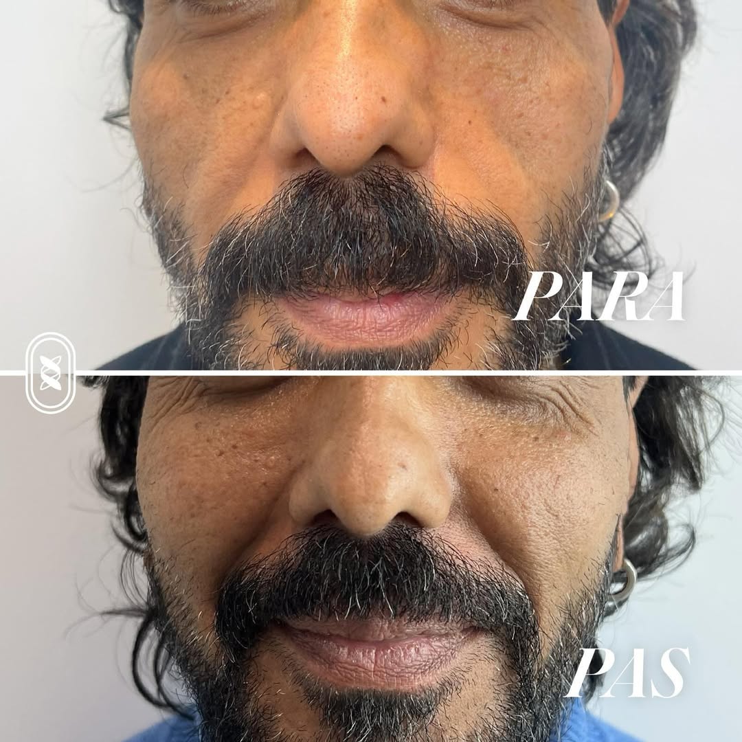 Jamber before and after result, case 11