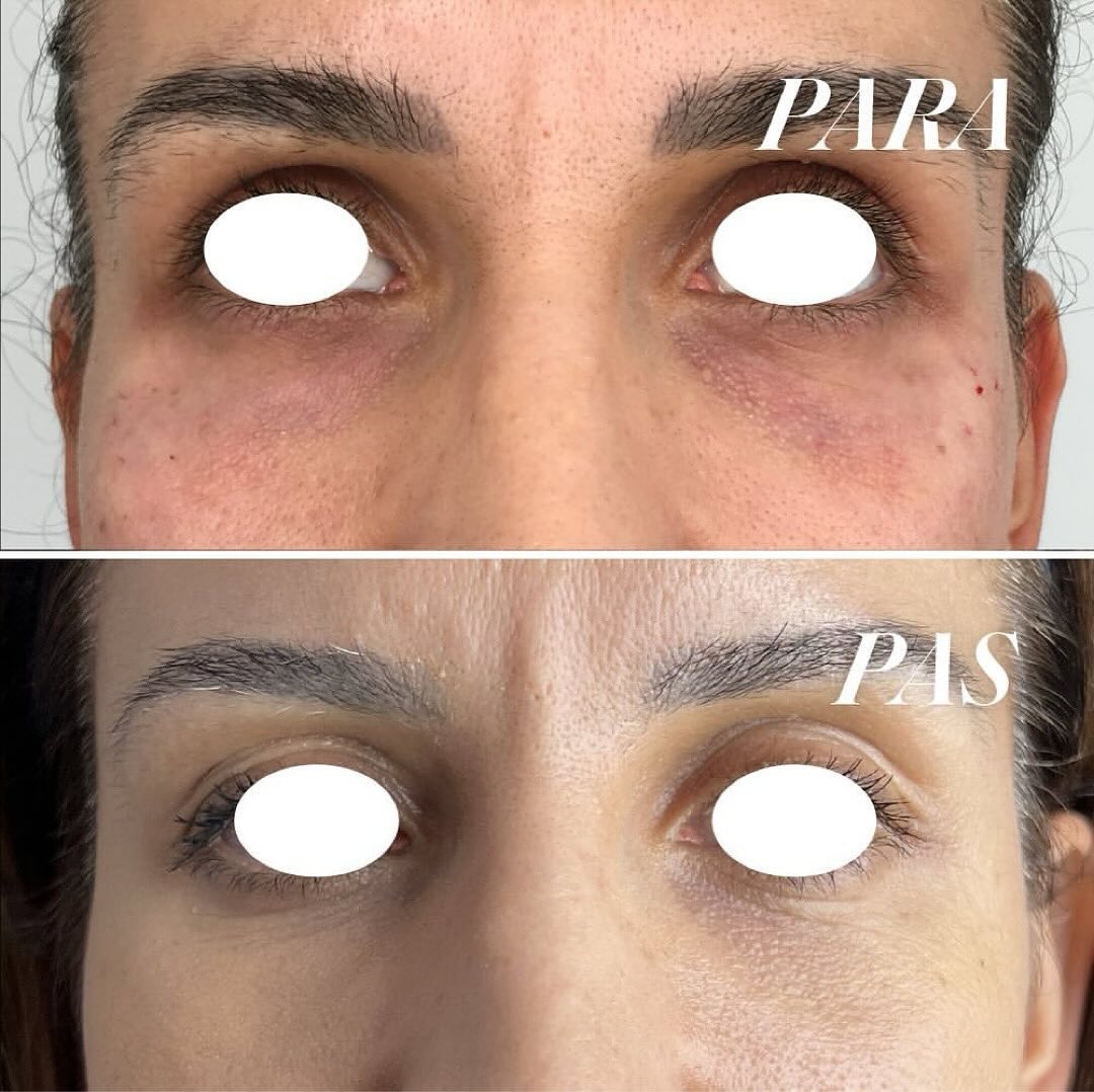 Jamber before and after result, case 9